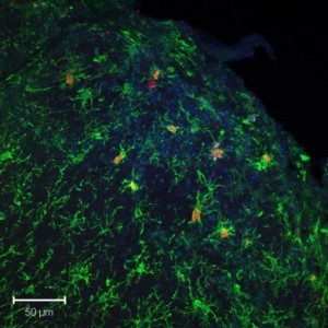 Inflammed microglia in the olfactory bulb