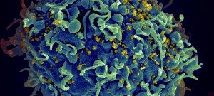 Virus HIV1