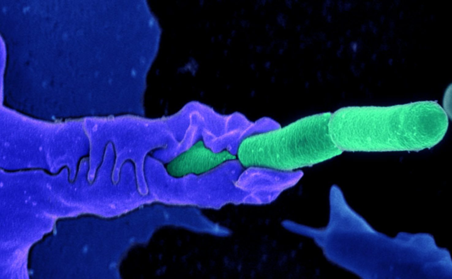 Bacillus anthracis Сибирская язва. Bacillus anthracis патогенность. Возбудитель бацилла антрацис.