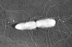 Salmonella typhimurium avec flagelles péritriches (cils). Espèce bactérienne à l'origine de toxi-infections alimentaires.