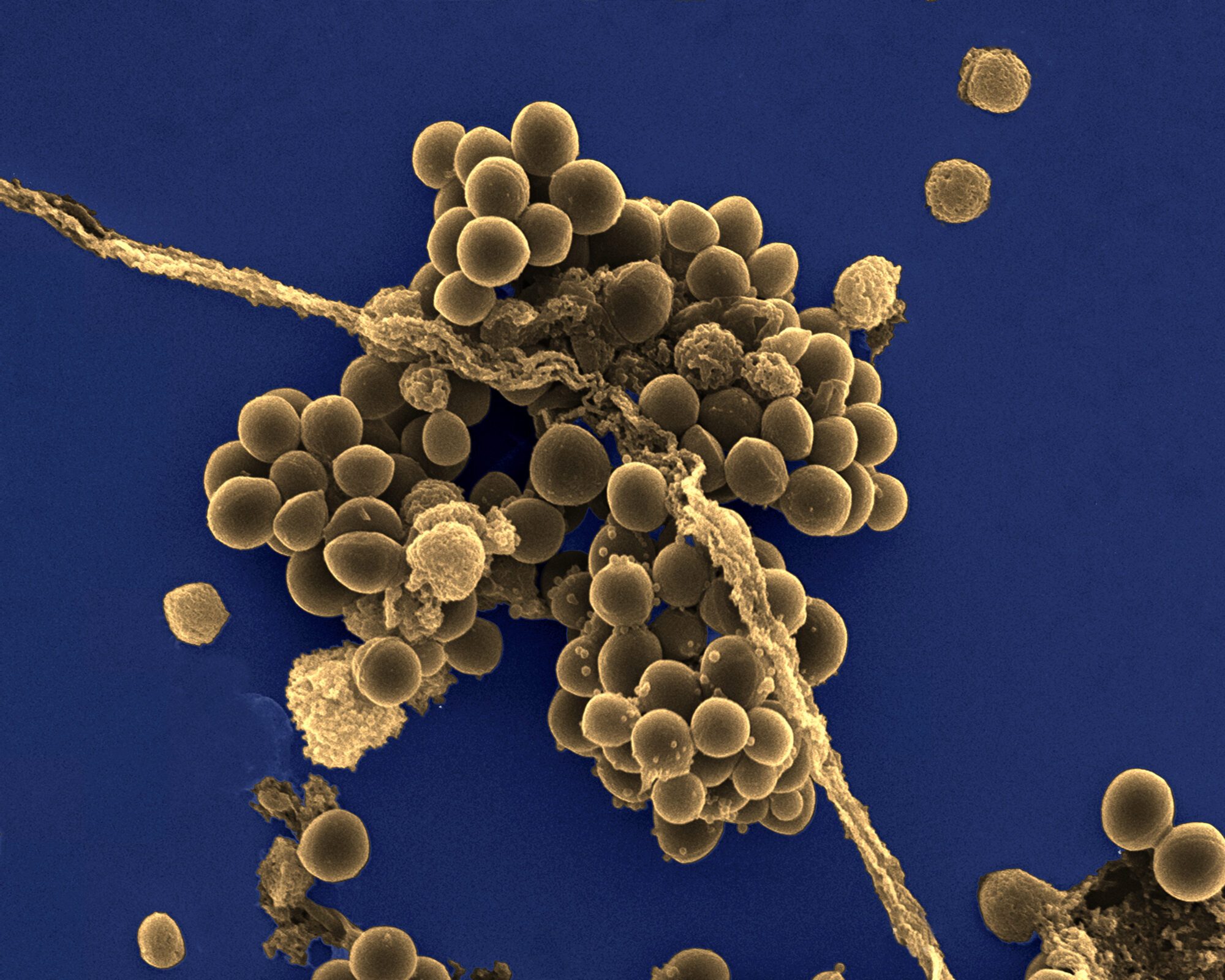 Бактерии staphylococcus aureus. Стафилококк ауреус микроскоп. St. aureus (золотистый стафилококк. Стафилококк ауреус под микроскопом. Метициллинрезистентный золотистый стафилококк.