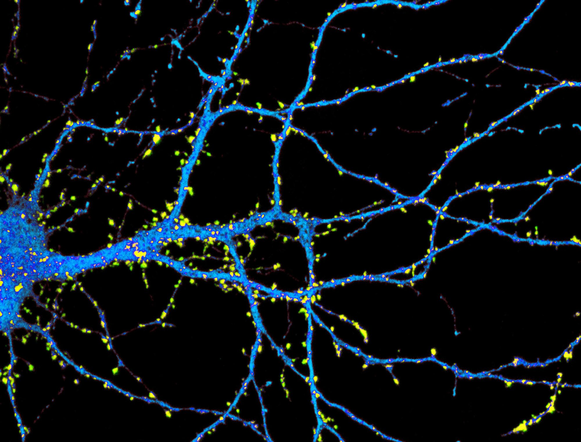 Thomas Bourgeron - Human Genetics and Cognitive Functions - Research -  Institut Pasteur