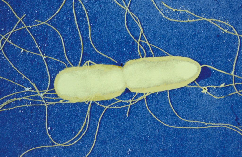 Francois-Xavier Weill - Escherichia coli, Shigella ...