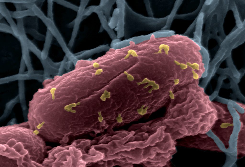 ecoli-phage.jpg