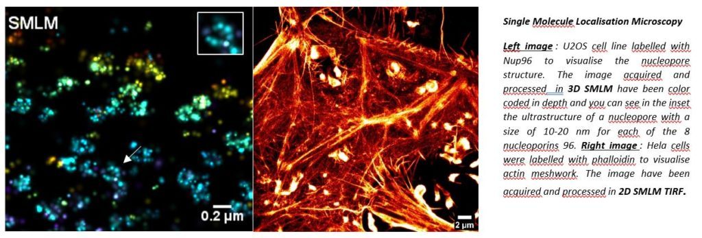 Single Molecule Localisation Microscopy Left image : U2OS cell line labelled with Nup96 to visualise the nucleopore structure. The image acquired and processed in 3D SMLM have been color coded in depth and you can see in the inset the ultrastructure of a nucleopore with a size of 10-20 nm for each of the 8 nucleoporins 96. Right image : Hela cells were labelled with phalloidin to visualise actin meshwork. The image have been acquired and processed in 2D SMLM TIRF.