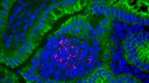 Tissu intestinal de gerbille infecté par Listeria monocytogenes. Listeria monocytogenes est marquée en rouge, la E-cadhérine des cellules épithéliales en vert, et les noyaux cellulaires en bleu.